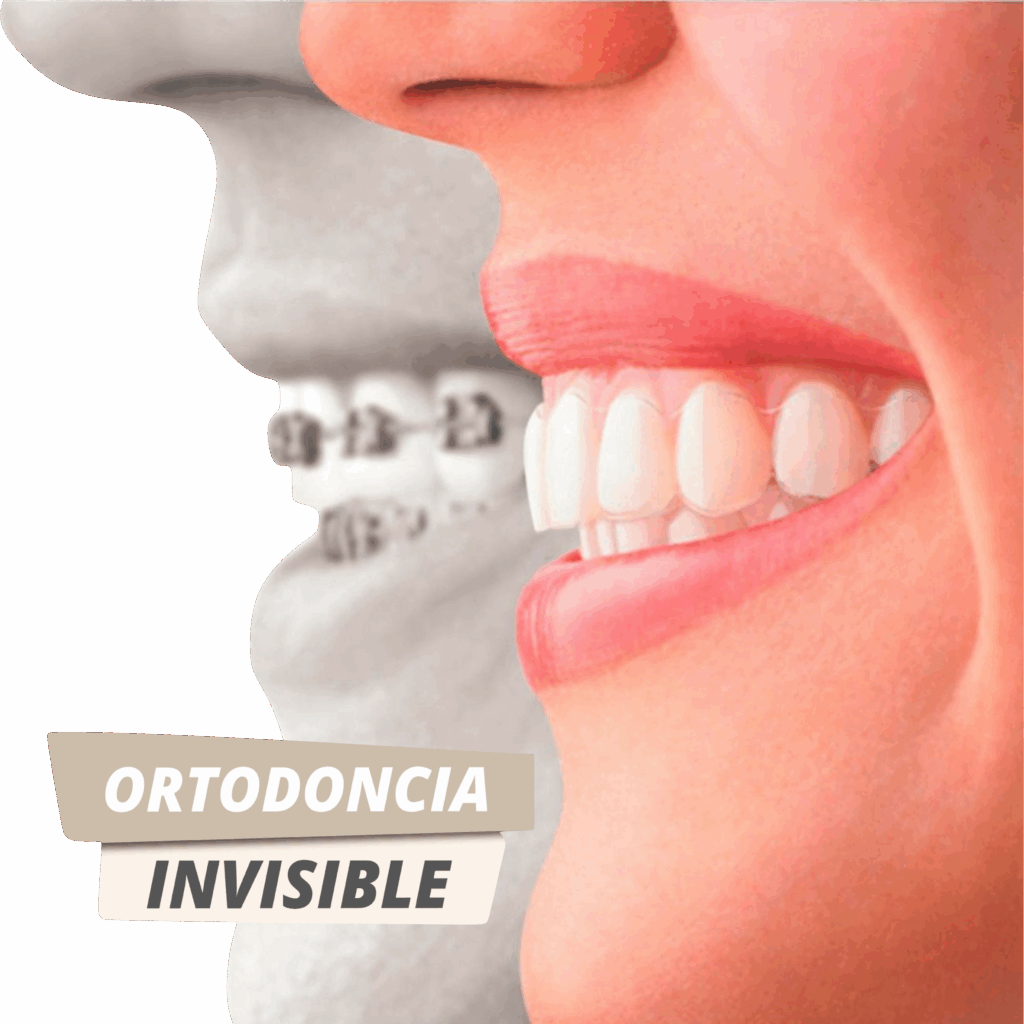 ortodoncia invisible ibague