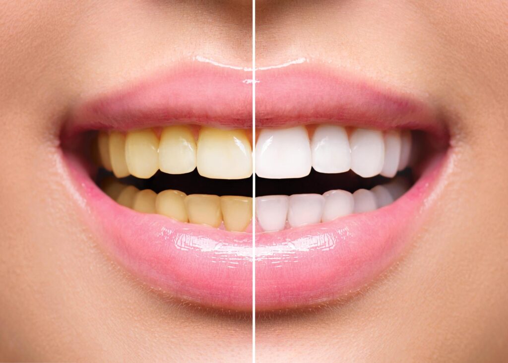 shutterstock 446773795 1 scaled 1